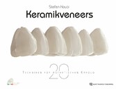 Keramikveneers