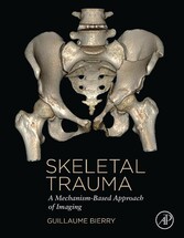 Skeletal Trauma