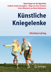 Künstliche Kniegelenke