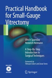 Practical Handbook for Small-Gauge Vitrectomy