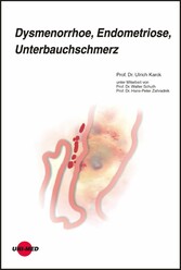 Dysmenorrhoe, Endometriose, Unterbauchschmerz