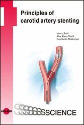 Principles of carotid artery stenting