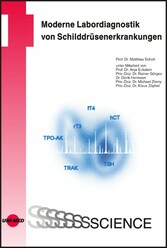 Moderne Labordiagnostik von Schilddrüsenerkrankungen