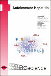 Autoimmune Hepatitis