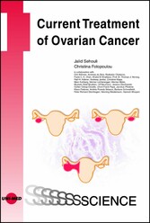 Current Treatment of Ovarian Cancer