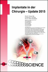 Implantate in der Chirurgie - Update 2015