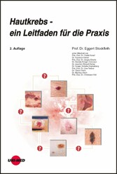 Hautkrebs - ein Leitfaden für die Praxis