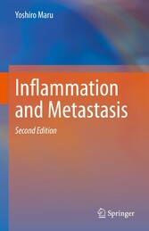 Inflammation and Metastasis