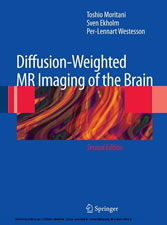 Diffusion-Weighted MR Imaging of the Brain