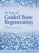 30 Years of Guided Bone Regeneration