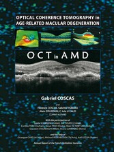 Optical Coherence Tomography in Age-Related Macular Degeneration