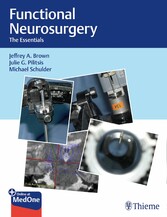 Functional Neurosurgery