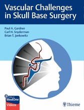 Vascular Challenges in Skull Base Surgery