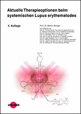 Aktuelle Therapieoptionen beim systemischen Lupus erythematodes