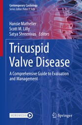 Tricuspid Valve Disease