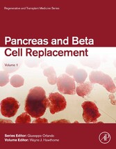 Pancreas and Beta Cell Replacement