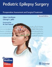 Pediatric Epilepsy Surgery