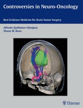 Controversies in Neuro-Oncology