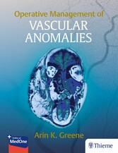 Operative Management of Vascular Anomalies