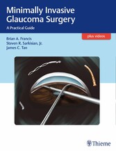 Minimally Invasive Glaucoma Surgery