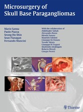 Microsurgery of Skull Base Paragangliomas