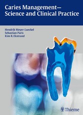 Caries Management - Science and Clinical Practice