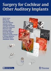 Surgery for Cochlear and Other Auditory Implants