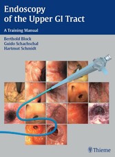 Endoscopy of the Upper GI Tract