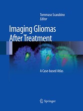 Imaging Gliomas After Treatment