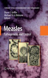 Measles