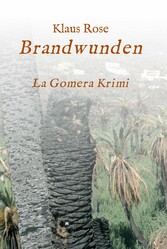 Brandwunden