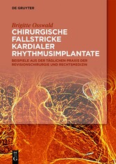 Chirurgische Fallstricke kardialer Rhythmusimplantate