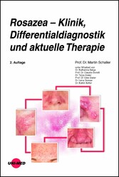 Rosazea - Klinik, Differentialdiagnostik und aktuelle Therapie