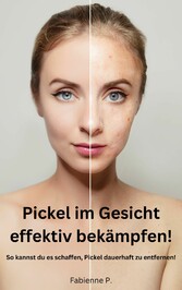 Pickel im Gesicht effektiv bekämpfen!