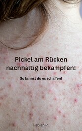 Pickel am Rücken nachhaltig bekämpfen!