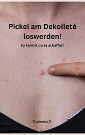 Pickel am Dekolleté loswerden!