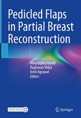 Pedicled Flaps in Partial Breast Reconstruction