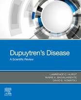 Dupuytren's Disease - E-BOOK