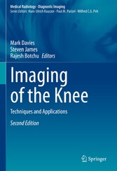 Imaging of the Knee