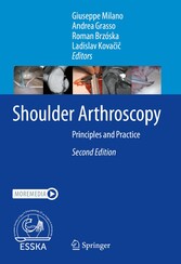 Shoulder Arthroscopy