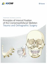 Principles of Internal Fixation of the Craniomaxillofacial Skeleton