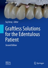 Graftless Solutions for the Edentulous Patient