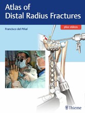 Atlas of Distal Radius Fractures