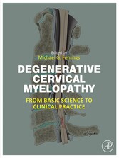 Degenerative Cervical Myelopathy