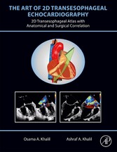 The Art of 2D Transesophageal Echocardiography