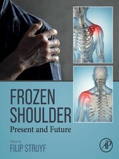 Frozen Shoulder