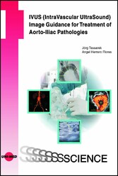 IVUS (IntraVascular UltraSound) Image Guidance for Treatment of Aorto-Iliac Pathologies