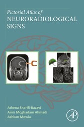 Pictorial Atlas of Neuroradiological Signs