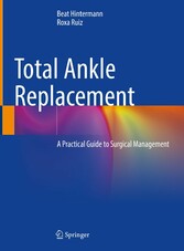 Total Ankle Replacement