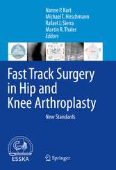 Fast Track Surgery in Hip and Knee Arthroplasty